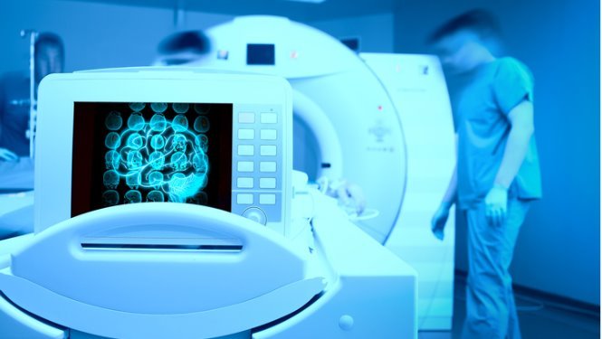 扫描患者大脑图片.jpg